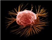 نانودارویی جدید برای مقابله با سرطان بدخیم پستان