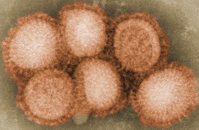 تاریخ آنفلوآنزا را باید از نو نوشت؟