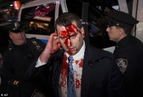 پاشیدن خون به صورت پلیس نیویورک