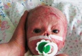 سوختن نوزاد 3 روزه در دستگاه فتوتراپی بیمارستان/ والدین سنگدل نوزاد بی‌گناه را در بیمارستان رها کردند:تصویر