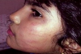ضرب و شتم دختر 6 ساله توسط دندانپزشک اصفهانی