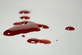 4 نفر بر سر تقسیم آبدوغ خیار مجروح شدند +عکس