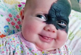 صورت عجیب نوزاد، والدینش را به وحشت انداخت! +تصاویر